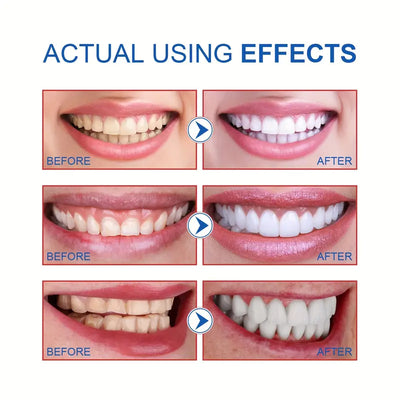SP-6 Ultra Whitening Toothpaste | Best Whitening Toothpaste